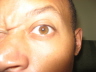 2007 07 29 Owww my eye my eye